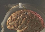 L'implant permet de déplacer ce bras robotisé par la pensé ©