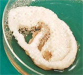 Le cartilage imprimé en 3D © The Times Of India